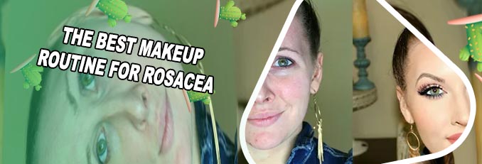 Best foundation for rosacea